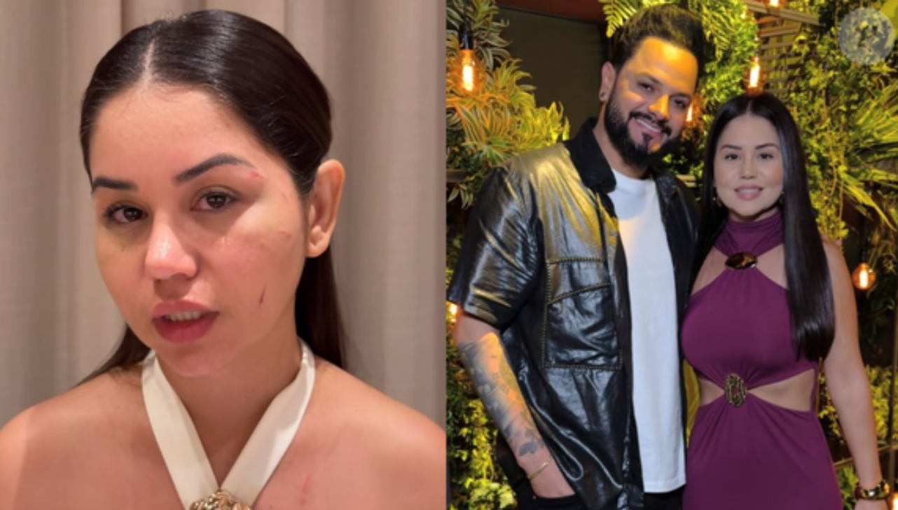 Esposa de Diego, da dupla com Victor Hugo, é agredida